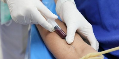 Estudio británico sugiere que un análisis de sangre podría acelerar diagnóstico del cáncer